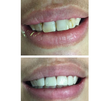 family dentistry